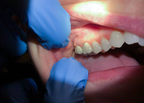 Best Walk-In Emergency Dentist in Hilliard, FL